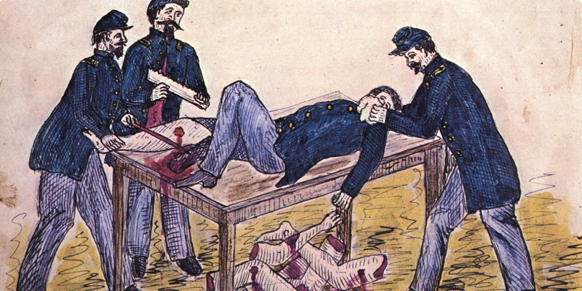 After Amputation- Civil War Prosthetics - National Museum of Civil War