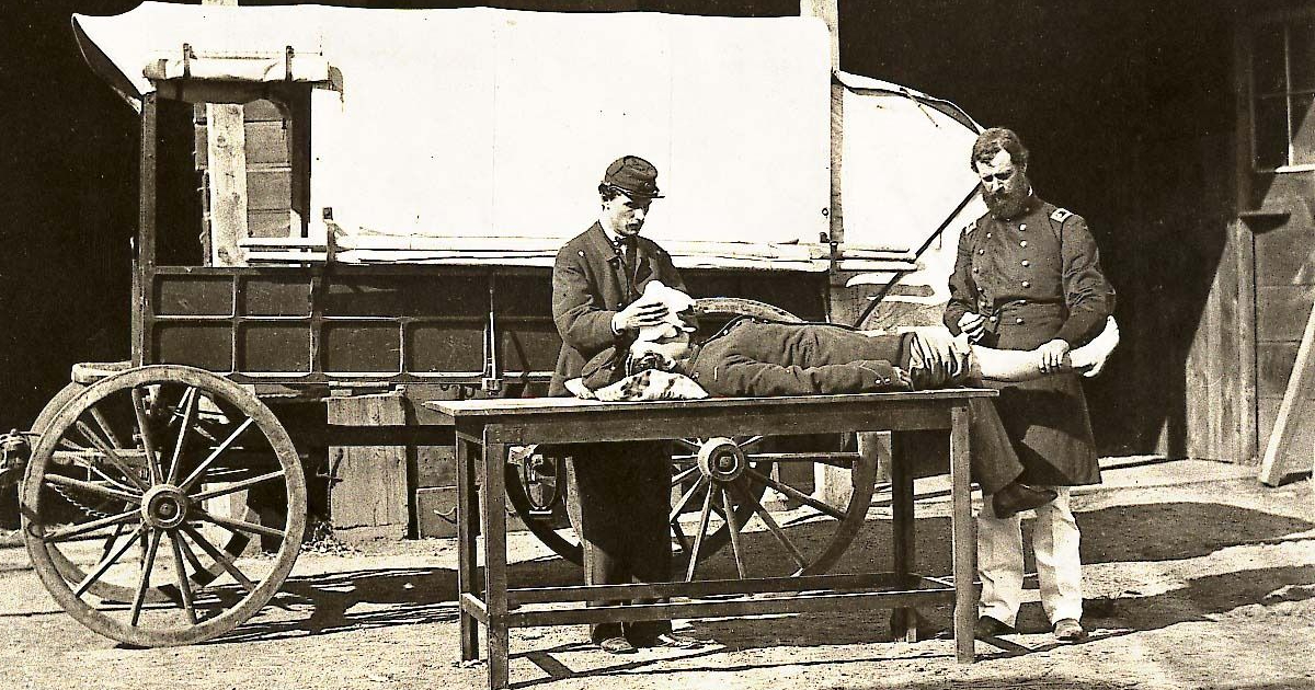 Anesthesia in the Civil War National Museum of Civil War Medicine