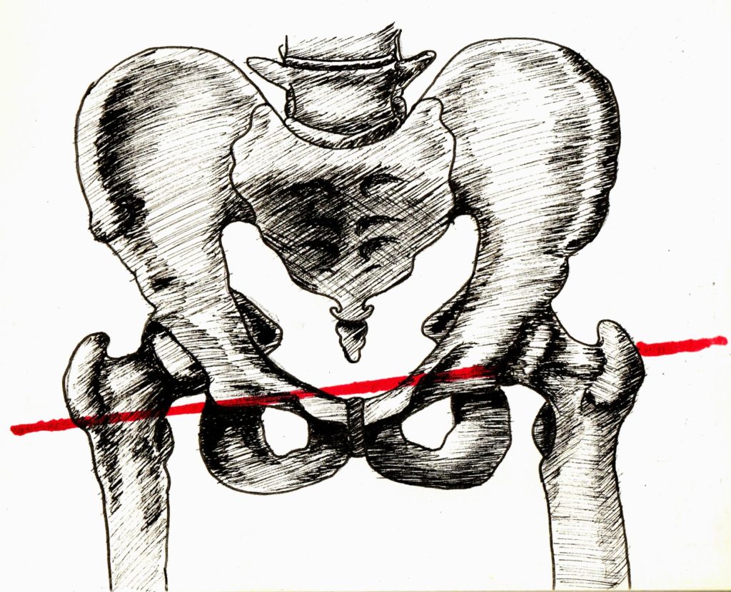 Author's sketch of the bullet's path through Chamberlain's body