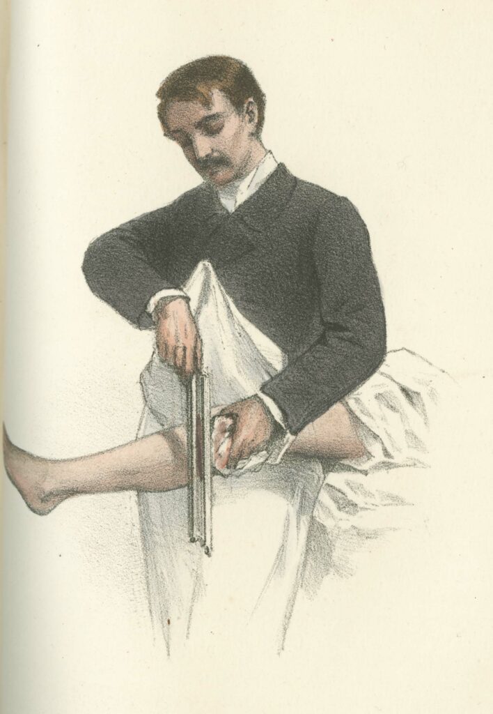 Sketch of an amputation c. 1867